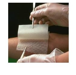 GARZA MEDICATA BACTIGRAS CON CLOREXIDINA ACETATO 0,5% 15X20CM 10 PEZZI - Farmacia De Pasquale