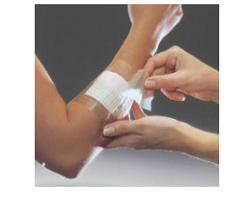 FILM ADESIVO IN POLIURETANO OPSITE FLEXIFIX IN ROTOLO TRASPARENTE IMPERMEABILE PER FISSAGGIO DI MEDICAZIONI E CATETERI LARGHEZZA 15 CM LUNGHEZZA 10 M 1 PEZZO - Farmacia De Pasquale