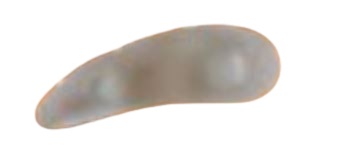 CUSCINETTO ORIONE G114 3 ANELLI PER DITA A MARTELLO DESTRO MISURA UNICA - Farmacia De Pasquale